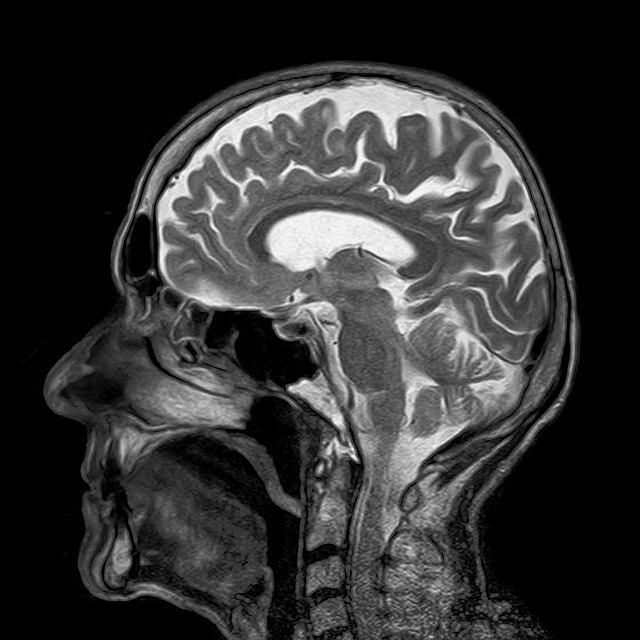 Рентген мозга
