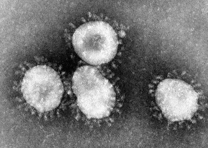 коронавирус, коронавирусная инфекция, лабораторное обследование